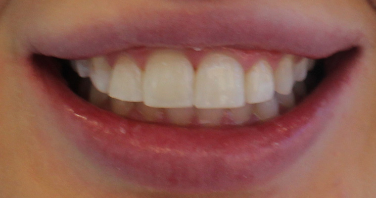 After