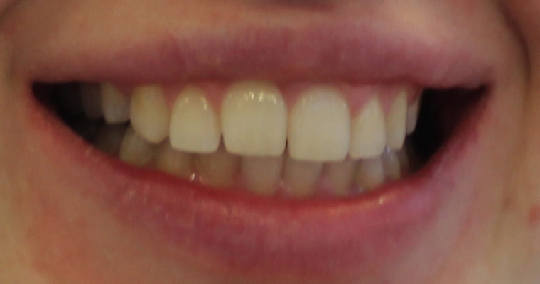 Before