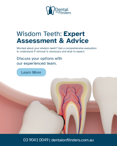 Medical illustration of an impacted wisdom tooth pushing against a molar.