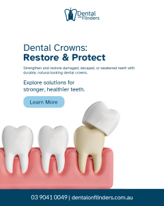 3D illustration of a dental crown being placed over a prepared tooth.