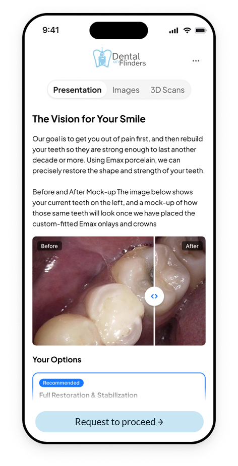 A Dental on Flinders Care Pack on a phone, showing the treatment presentation, before and after images, and treatment options